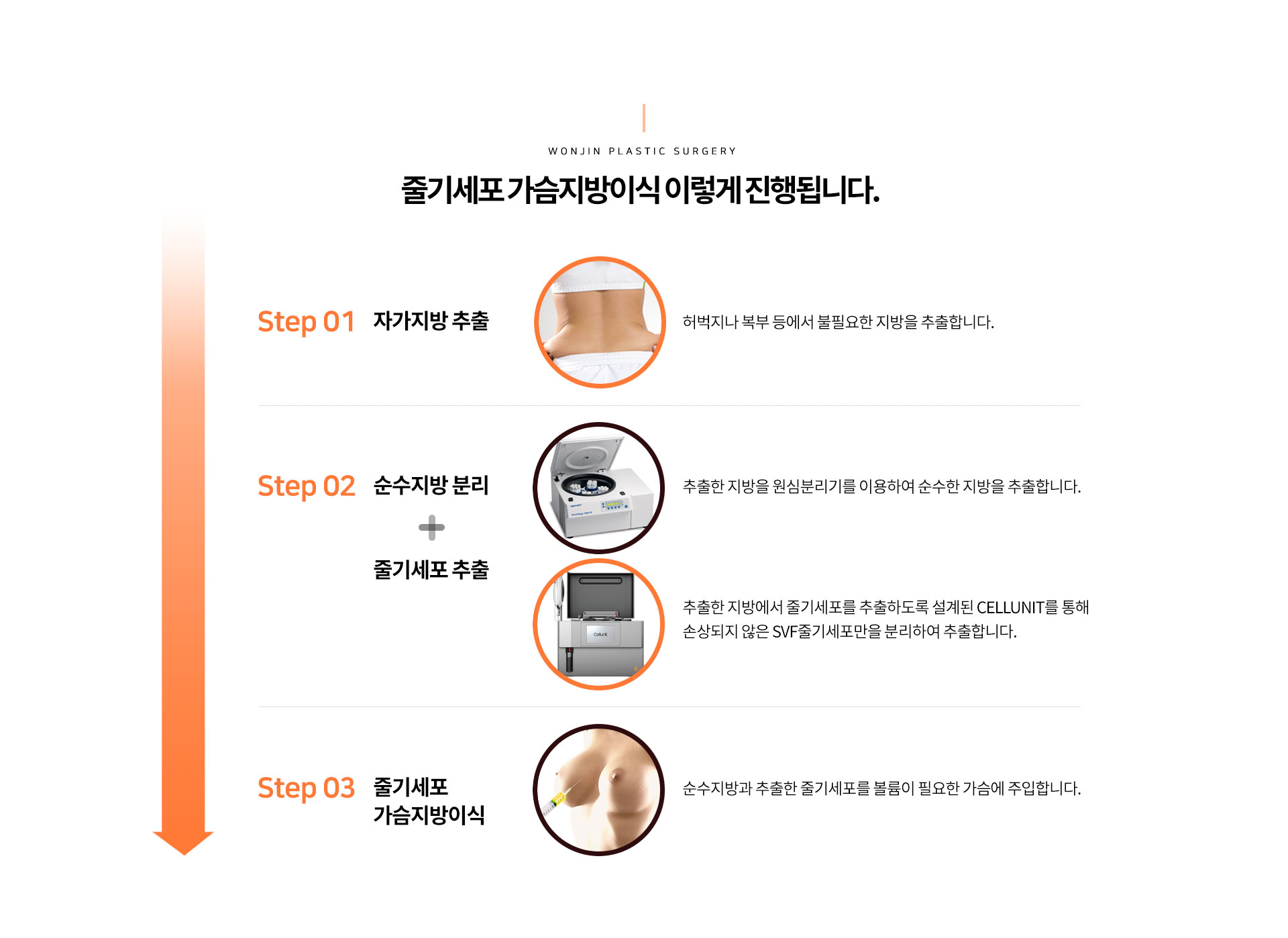 줄기세포 가슴지방이식 이렇게 진행됩니다.
		STEP 01 자가지방 추출 허벅지나 복부 등에서 불필요한 지방을 추출합니다.
		STEP 02 순수지방 분리 추출한 지방을 원심분리기를 이용하여 순수한 지방을 추출합니다.
		+줄기세포 추출 추출한 지방을 줄기세포를 추출하도록 설계된 CELLUNIT를 통해
		손상되지 않은 SVF줄기세포만을 분리하여 추출합니다.
		STEP 03 줄기세포 가슴지방이식 순수지방과 줄기세포를 볼륨이 필요한 가슴에 주입합니다.
		