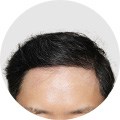 성형 수술 대표 이미지