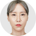 리프팅 이미지