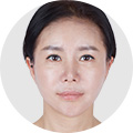 리프팅 이미지