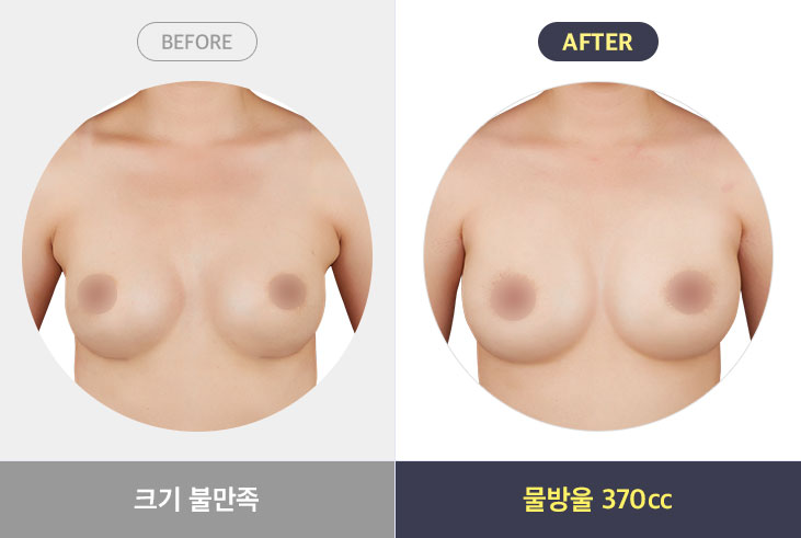 크기불만족 - 물방울 370cc