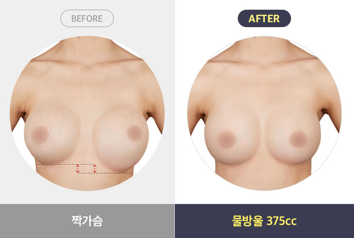 짝가슴 - 물방울 375cc