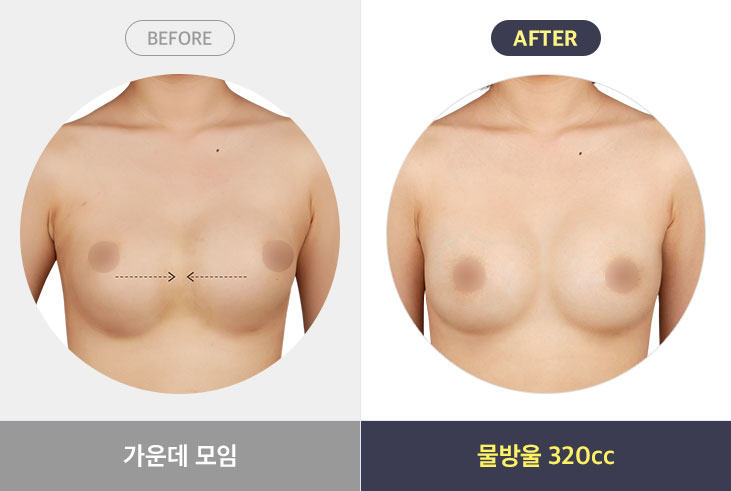 가운데 모임 - 물방울 320cc