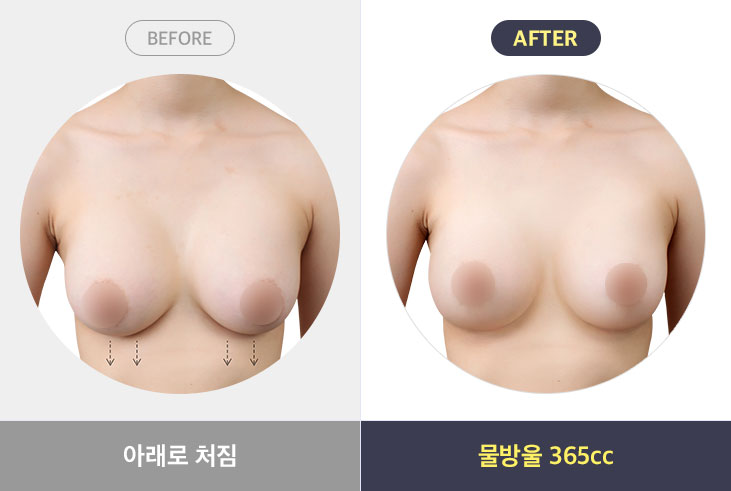 아래로 처짐 - 물방울 365cc