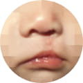 성형 수술 대표 이미지