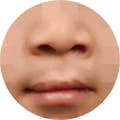 성형 수술 대표 이미지