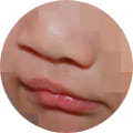 성형 수술 대표 이미지