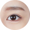 눈 성형 이미지
