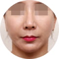 성형 수술 대표 이미지