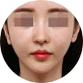 성형 수술 대표 이미지