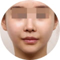 성형 수술 대표 이미지