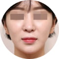 성형 수술 대표 이미지