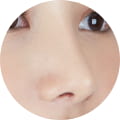 성형 수술 대표 이미지