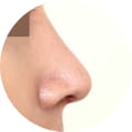 성형 수술 대표 이미지