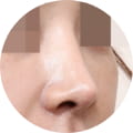 성형 수술 대표 이미지