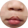 성형 수술 대표 이미지