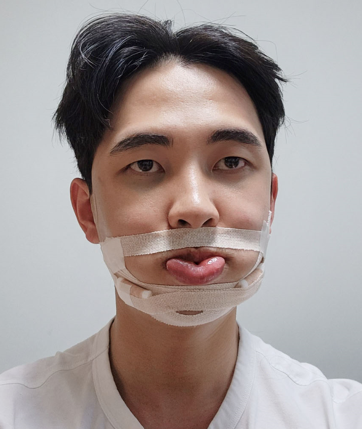 이미지