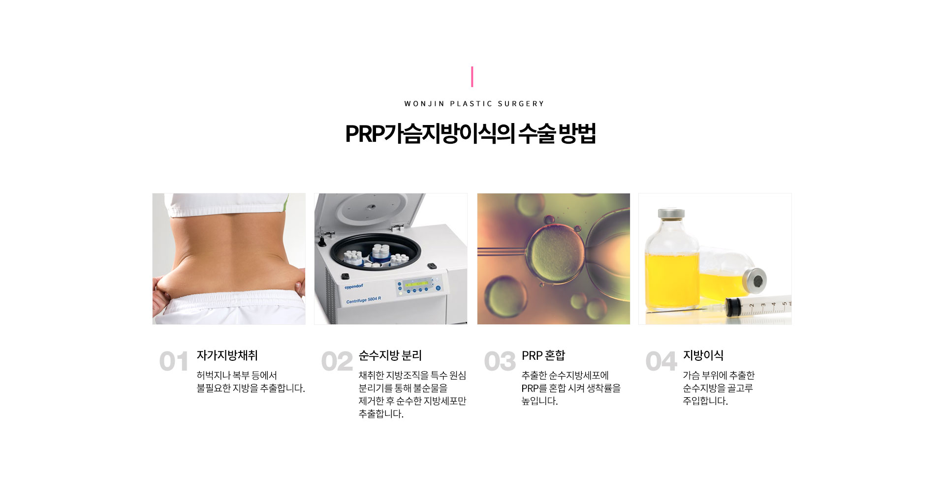 PRP가슴지방이식의 수술 방법 
		01 자가지방채취
		허벅지나 복부 등에서 불필요한 지방을 추출합니다. 
		02 순수지방 분리
		채취한 지방조직을 특수 원심 분리기를 통해 불순물을 제거한 후 순수한 지방세포만 추출합니다. 
		03 PRP 혼합
		추출한 순수지방세포에 PRP를 혼합 시켜 생착률을 높입니다. 
		04 지방이식
		가슴 부위에 추출한 순수지방을 골고루 주입합니다.
	