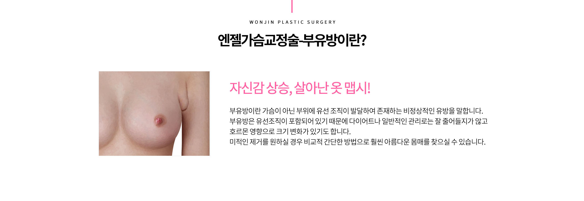 엔젤가슴교정술-부유방이란?
		자신감 상승, 살아난 옷 맵시!

		부유방이란 가슴이 아닌 부위에 유선 조직이 발달하여 존재하는 비정상적인 유방을 말합니다. 
		부유방은 유선조직이 포함되어 있기 때문에 다이어트나 일반적인 관리로는 잘 줄어들지가 않고
		호르몬 영향으로 크기 변화가 있기도 합니다.
		미적인 제거를 원하실 경우 비교적 간단한 방법으로 훨씬 아름다운 몸매를 찾으실 수 있습니다.  
		