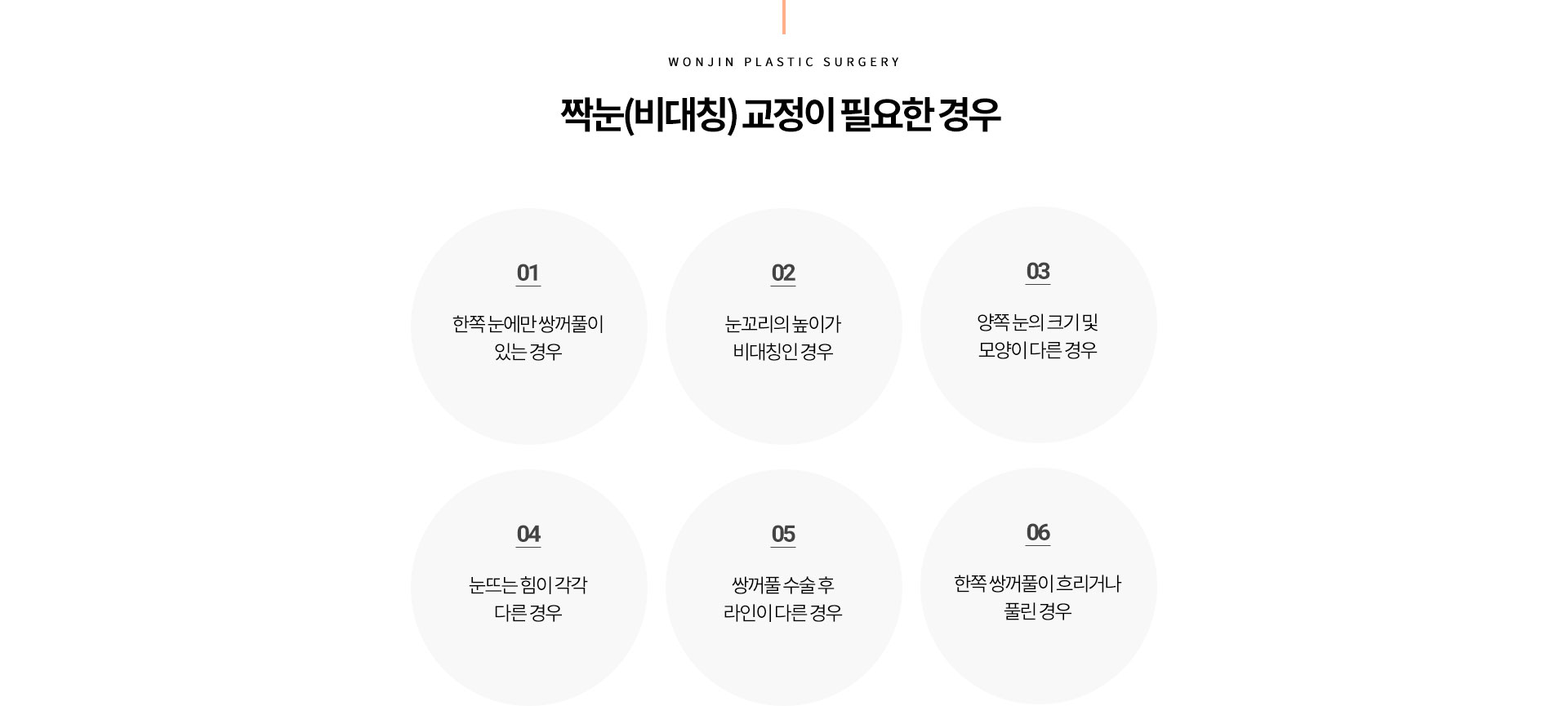 짝눈(비대칭) 교정이 필요한 경우
				한쪽 눈에만 쌍꺼풀이 있는 경우
눈꼬리의 높이가 비대칭인 경우
양쪽 눈의 크기 및 모양이 다른 경우
눈뜨는 힘이 각각 다른 경우
쌍꺼풀 수술 후 라인이 다른 경우
한쪽 쌍꺼풀이 흐리거나 풀린 경우
