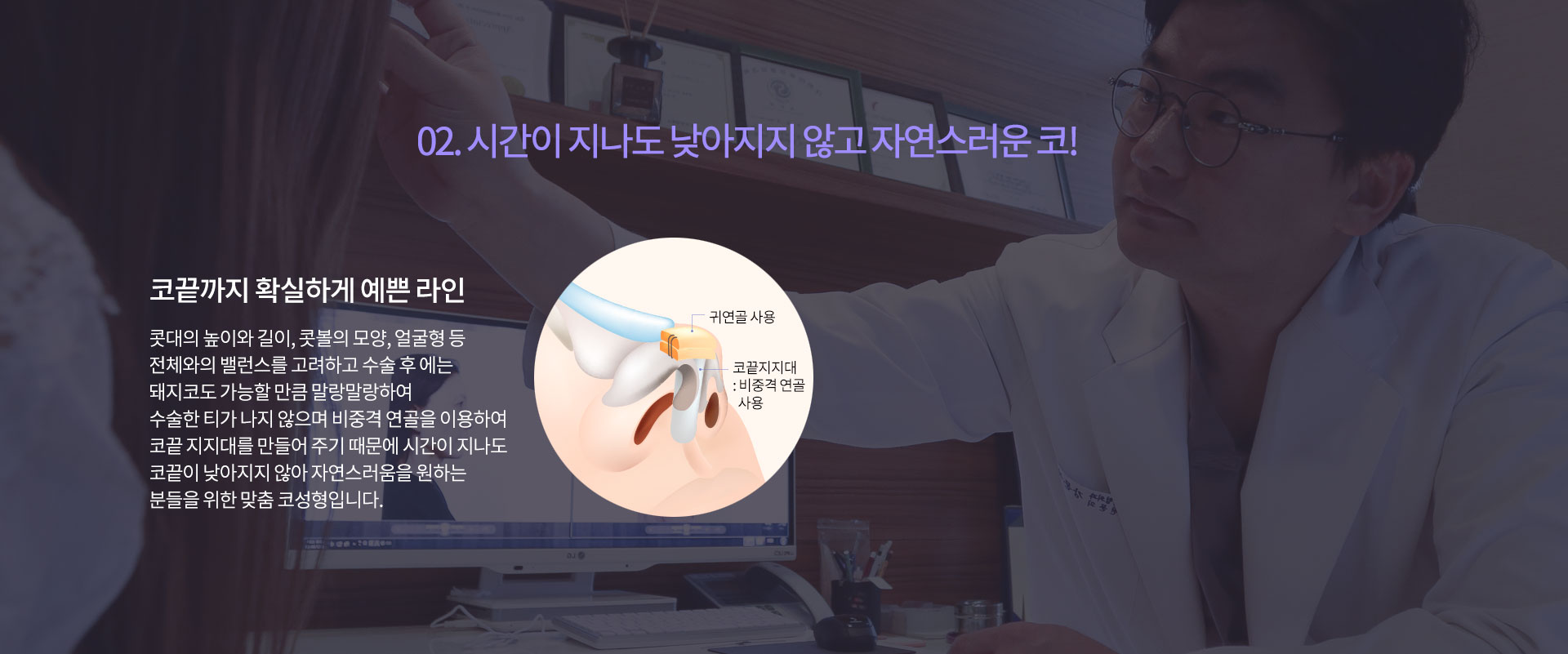 02. 시간이 지나도 낮아지지 않고 자연스러운 코!
				코끝까지 확실하게 예쁜 라인
콧대의 높이와 길이, 콧볼의 모양, 얼굴형 등
전체와의 밸런스를 고려하고 수술 후 에는
돼지코도 가능할 만큼 말랑말랑하여 
수술한 티가 나지 않으며 비중격 연골을 이용하여
코끝 지지대를 만들어 주기 때문에 시간이 지나도
코끝이 낮아지지 않아 자연스러움을 원하는
분들을 위한 맞춤 코성형입니다.
귀연골 사용 코끝지지대: 비중격 연골 사용

