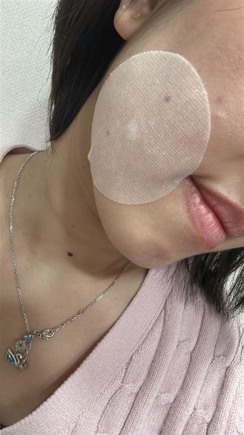 이미지 1
