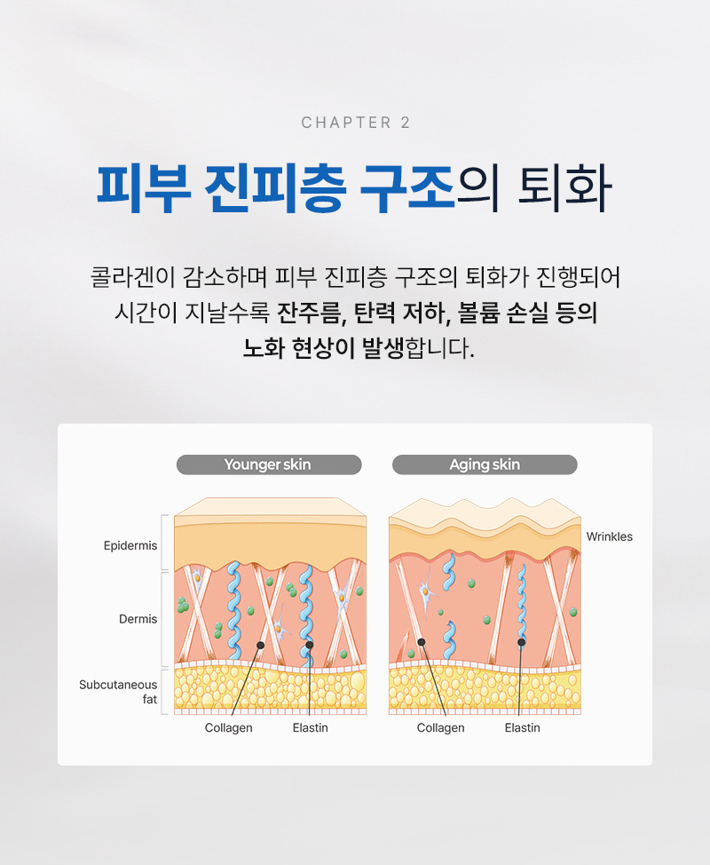 광고랜딩