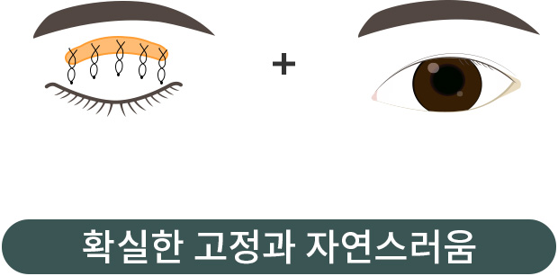 확실한 고정과 자연스러움