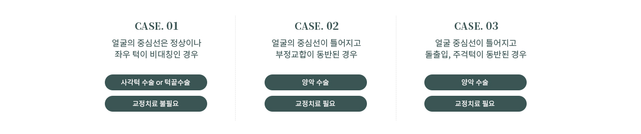 안면 비대칭 이미지