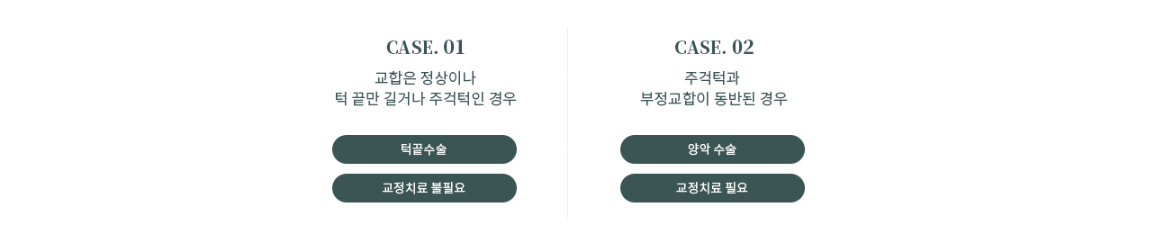 주걱턱 이미지