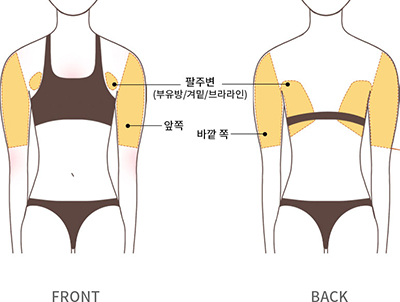 팔 지방 흡입 이미지