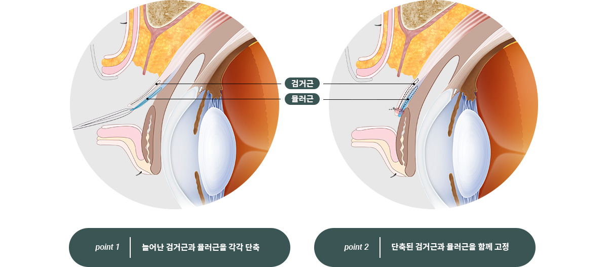 WJ 원진 더블유착 특별함 이미지