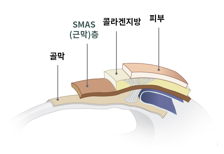 안면거상술 이미지