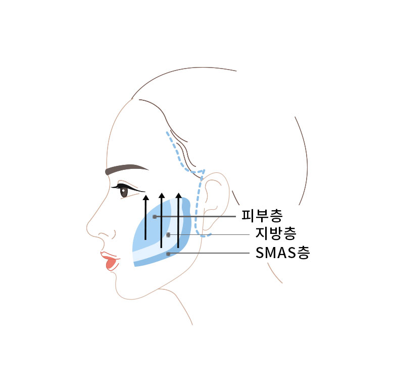 불필요한 피부 제거 이미지