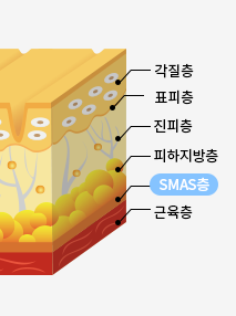 절개식