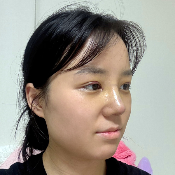 앗췅